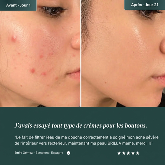 Tête de douche avec système de filtration en 15 étapes + vitamine C